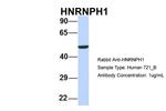 hnRNP H1 Antibody in Western Blot (WB)