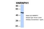 hnRNP H1 Antibody in Western Blot (WB)