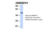 hnRNP H1 Antibody in Western Blot (WB)