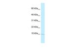 BANF2 Polyclonal Antibody