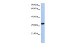 CAPZA3 Polyclonal Antibody