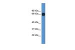 CPNE6 Polyclonal Antibody