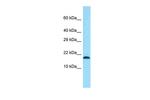 TMEM50B Polyclonal Antibody