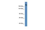 WDR87 Antibody in Western Blot (WB)