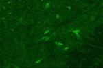 SPSB2 Polyclonal Antibody