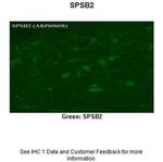SPSB2 Polyclonal Antibody
