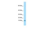KRTAP3-3 Polyclonal Antibody