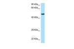 RCC1 Polyclonal Antibody