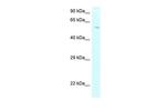 P4HA2 Polyclonal Antibody