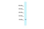 NDUFA6 Polyclonal Antibody