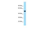 SUGCT Polyclonal Antibody