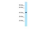 UBE2Q1 Polyclonal Antibody