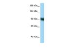 ZFP62 Polyclonal Antibody