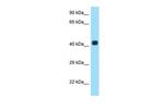 AADACL3 Polyclonal Antibody