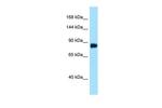 DDIAS Polyclonal Antibody
