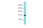 Gm11686 Polyclonal Antibody