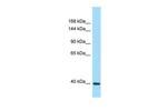 DRP2 Polyclonal Antibody