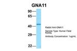 GNA11 Polyclonal Antibody