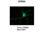 GPM6A Antibody in Immunohistochemistry (IHC)