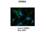 GPM6A Antibody in Immunohistochemistry (IHC)