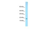 GMFB Polyclonal Antibody