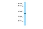 RDH8 Polyclonal Antibody