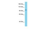 Erc2 Polyclonal Antibody