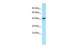 KIR2DL5B Polyclonal Antibody