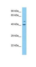 FAM148B Polyclonal Antibody