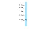 GGNBP1 Polyclonal Antibody