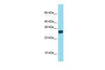 SPACA3 Polyclonal Antibody