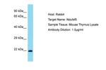 NDUFAF5 Antibody in Western Blot (WB)
