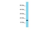 Gm13194 Polyclonal Antibody