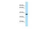 ASB14 Polyclonal Antibody