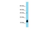 DUSP15 Polyclonal Antibody