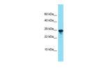 SPCS2 Polyclonal Antibody