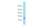TMEM190 Polyclonal Antibody