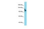 SKIDA1 Polyclonal Antibody