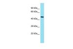 FAM221B Polyclonal Antibody