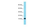 FAM25A Polyclonal Antibody