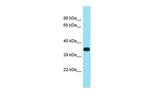 F102B Polyclonal Antibody