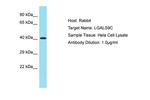 LGALS9C Polyclonal Antibody