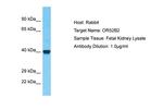 OR52B2 Polyclonal Antibody