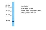 OTOGL Polyclonal Antibody