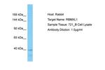 RBMXL1 Polyclonal Antibody