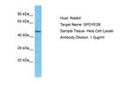 SPDYE2B Polyclonal Antibody