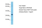 SPDYE2B Polyclonal Antibody