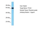 TTC22 Polyclonal Antibody
