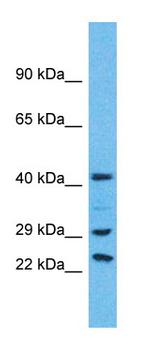 USP41 Polyclonal Antibody