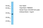 TMEM236 Antibody in Western Blot (WB)